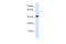 Cholinergic Receptor Nicotinic Alpha 1 Subunit antibody, 31-131, ProSci, Enzyme Linked Immunosorbent Assay image 