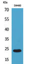 Fibroblast Growth Factor 9 antibody, STJ96544, St John