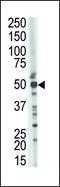 Tumor Susceptibility 101 antibody, PA5-12039, Invitrogen Antibodies, Western Blot image 