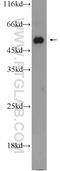 Activin A Receptor Type 1B antibody, 10086-1-AP, Proteintech Group, Western Blot image 