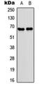 Nuclear Receptor Subfamily 4 Group A Member 3 antibody, orb256728, Biorbyt, Western Blot image 