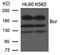 BCR Activator Of RhoGEF And GTPase antibody, A00022-1, Boster Biological Technology, Western Blot image 