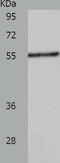 Chromaffin granule amine transporter antibody, TA323893, Origene, Western Blot image 