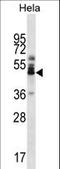 Zinc Finger Protein 174 antibody, LS-C160832, Lifespan Biosciences, Western Blot image 