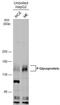 ATP Binding Cassette Subfamily B Member 1 antibody, NBP2-17251, Novus Biologicals, Western Blot image 