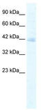 Potassium Channel Tetramerization Domain Containing 18 antibody, TA338737, Origene, Western Blot image 