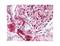 NAD(P)H Quinone Dehydrogenase 1 antibody, LS-C82339, Lifespan Biosciences, Immunohistochemistry paraffin image 