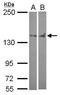 Protein Tyrosine Phosphatase Non-Receptor Type 14 antibody, NBP2-15069, Novus Biologicals, Western Blot image 