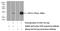 Guanylate Kinase 1 antibody, 10755-1-AP, Proteintech Group, Western Blot image 