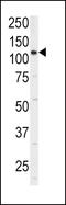 Integrin Subunit Alpha 6 antibody, LS-B3626, Lifespan Biosciences, Western Blot image 