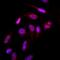 Small Ubiquitin Like Modifier 2 antibody, GTX50000, GeneTex, Immunofluorescence image 