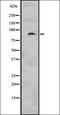 Protein Kinase C Epsilon antibody, orb336654, Biorbyt, Western Blot image 
