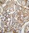 HRas Proto-Oncogene, GTPase antibody, PA5-14863, Invitrogen Antibodies, Immunohistochemistry paraffin image 