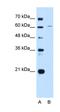 Mucin 3B, Cell Surface Associated antibody, orb325222, Biorbyt, Western Blot image 