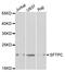 Surfactant Protein C antibody, PA5-76631, Invitrogen Antibodies, Western Blot image 