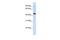 Solute Carrier Family 41 Member 3 antibody, GTX46859, GeneTex, Western Blot image 