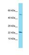 CTD Small Phosphatase 2 antibody, orb330860, Biorbyt, Western Blot image 