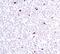 Lamin A/C antibody, PA5-17838, Invitrogen Antibodies, Immunohistochemistry paraffin image 