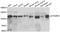 GTF2I Repeat Domain Containing 1 antibody, A6613, ABclonal Technology, Western Blot image 