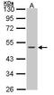 Keratin 15 antibody, GTX100572, GeneTex, Western Blot image 