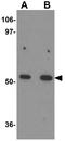 BTG3 Associated Nuclear Protein antibody, GTX17092, GeneTex, Western Blot image 