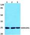 Rho GDP Dissociation Inhibitor Gamma antibody, A13055, Boster Biological Technology, Western Blot image 