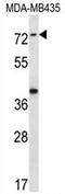 Synaptotagmin Like 1 antibody, AP54129PU-N, Origene, Western Blot image 
