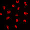 Estrogen Receptor 1 antibody, LS-C356039, Lifespan Biosciences, Immunofluorescence image 