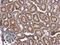 Coiled-Coil-Helix-Coiled-Coil-Helix Domain Containing 3 antibody, GTX119821, GeneTex, Immunohistochemistry paraffin image 