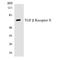 Transforming Growth Factor Beta Receptor 2 antibody, LS-C200780, Lifespan Biosciences, Western Blot image 