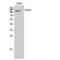 Collagen Type IX Alpha 1 Chain antibody, LS-C382829, Lifespan Biosciences, Western Blot image 