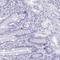 M-Phase Specific PLK1 Interacting Protein antibody, NBP2-31718, Novus Biologicals, Immunohistochemistry frozen image 