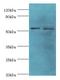 Patatin Like Phospholipase Domain Containing 2 antibody, LS-C378348, Lifespan Biosciences, Western Blot image 