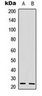 Interleukin 22 antibody, LS-C368612, Lifespan Biosciences, Western Blot image 