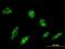 Origin Recognition Complex Subunit 4 antibody, MA5-19508, Invitrogen Antibodies, Immunofluorescence image 