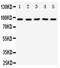 Neurotrophic Receptor Tyrosine Kinase 3 antibody, PA5-79766, Invitrogen Antibodies, Western Blot image 