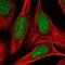 ADP-Ribosylhydrolase Like 2 antibody, NBP1-88834, Novus Biologicals, Immunofluorescence image 