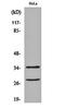 Cellular Communication Network Factor 6 antibody, orb159209, Biorbyt, Western Blot image 