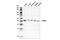 Melanoma antigen preferentially expressed in tumors antibody, 45084S, Cell Signaling Technology, Western Blot image 