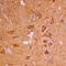 Neurocan antibody, PA5-47848, Invitrogen Antibodies, Immunohistochemistry paraffin image 