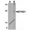 EF-Hand Domain Family Member D1 antibody, LS-B4638, Lifespan Biosciences, Western Blot image 