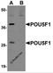 POU Class 5 Homeobox 1 antibody, 5581, ProSci, Western Blot image 