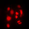 Serum/Glucocorticoid Regulated Kinase 1 antibody, LS-C358307, Lifespan Biosciences, Immunofluorescence image 