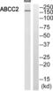 ATP Binding Cassette Subfamily C Member 2 antibody, abx014297, Abbexa, Western Blot image 