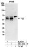 Thymine DNA Glycosylase antibody, A304-365A, Bethyl Labs, Immunoprecipitation image 
