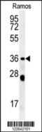 Neutrophil Cytosolic Factor 1 antibody, 62-088, ProSci, Western Blot image 