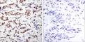 Signal Transducer And Activator Of Transcription 5A antibody, ab30648, Abcam, Immunohistochemistry paraffin image 