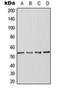 Actin Like 6A antibody, LS-C353877, Lifespan Biosciences, Western Blot image 