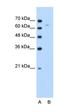 Thymocyte Selection Associated High Mobility Group Box antibody, orb329737, Biorbyt, Western Blot image 