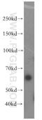 LSM14A MRNA Processing Body Assembly Factor antibody, 18336-1-AP, Proteintech Group, Western Blot image 